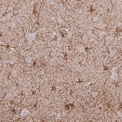 DNAL1 Antibody, Novus Biologicals 25 &mu;L, Unlabeled:Antibodies, Polyclonal