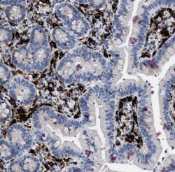 DNAM-1/CD226 Antibody, Novus Biologicals:Antibodies:Primary Antibodies