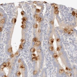 DNASE1 Antibody, Novus Biologicals:Antibodies:Primary Antibodies