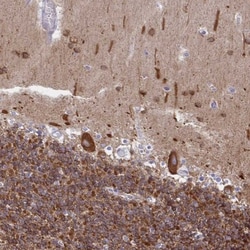 DNCIC1 Antibody, Novus Biologicals 25 &mu;L, Unlabeled:Antibodies, Polyclonal