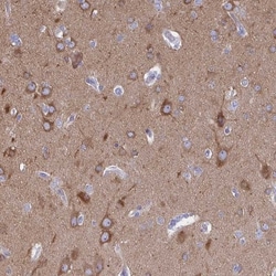 DNCIC1 Antibody, Novus Biologicals 25 &mu;L, Unlabeled:Antibodies, Polyclonal
