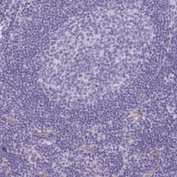 DNCIC1 Antibody, Novus Biologicals 25 &mu;L, Unlabeled:Antibodies, Polyclonal