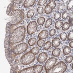 DNMBP Antibody, Novus Biologicals 0.1mL; Unlabeled:Antibodies, Polyclonal
