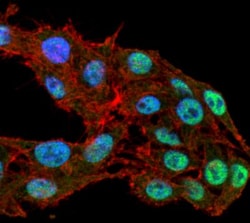 DNMT1 Antibody (11H8), Novus Biologicals 100ug; Unlabeled:Antibodies, Monoclonal