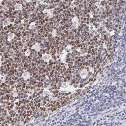 DNMT1 Antibody, Novus Biologicals 0.1mL; Unlabeled:Antibodies, Polyclonal