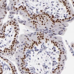 DNMT1 Antibody, Novus Biologicals 0.1mL; Unlabeled:Antibodies, Polyclonal