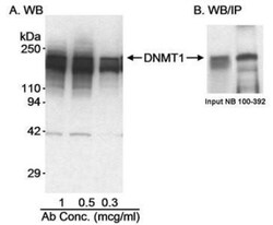 DNMT1 Antibody, Novus Biologicals 100 &mu;L | Buy Online | Novus Biologicals | Fisher Scientific