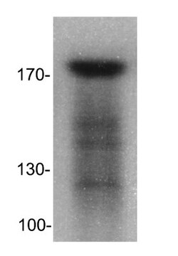 DNMT1 Antibody, Novus Biologicals 100 &mu;L | Buy Online | Novus Biologicals | Fisher Scientific