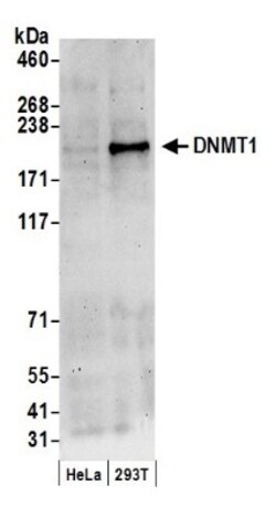 DNMT1 Antibody, Novus Biologicals 100 &mu;L | Buy Online | Novus Biologicals | Fisher Scientific