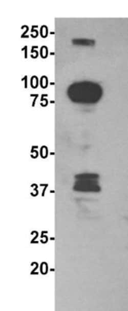 DNMT3A Antibody (64B1446) - BSA Free, Novus Biologicals:Antibodies:Primary