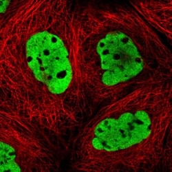 DNMT3A Antibody, Novus Biologicals 0.1mL; Unlabeled:Antibodies, Polyclonal