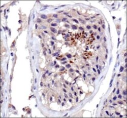 DNMT3A Antibody, Novus Biologicals:Antibodies:Primary Antibodies