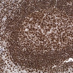 DNMT3A Antibody, Novus Biologicals 0.1mL; Unlabeled:Antibodies, Polyclonal
