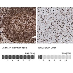 DNMT3A Antibody, Novus Biologicals 0.1mL; Unlabeled:Antibodies, Polyclonal