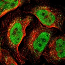 DNMT3B Antibody, Novus Biologicals:Antibodies:Primary Antibodies