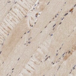 DNMT3B Antibody, Novus Biologicals:Antibodies:Primary Antibodies