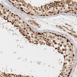 DNMT3B Antibody, Novus Biologicals:Antibodies:Primary Antibodies