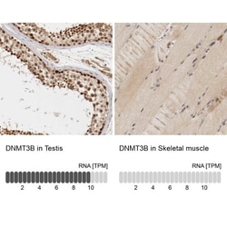 DNMT3B Antibody, Novus Biologicals:Antibodies:Primary Antibodies