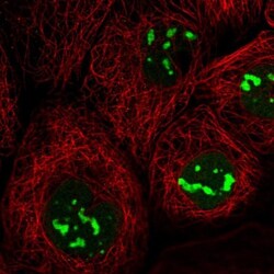 DNTTIP2 Antibody, Novus Biologicals 25 &mu;L | Buy Online | Novus Biologicals | Fisher Scientific