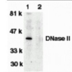 DNase II Antibody, Novus Biologicals 0.1mg; Unlabeled:Antibodies, Polyclonal