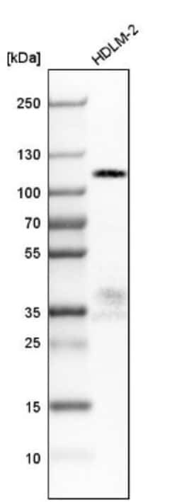 DOC1 Antibody, Novus Biologicals 25 &mu;L; Unlabeled:Antibodies, Polyclonal