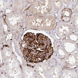 DOCK1 Antibody, Novus Biologicals:Antibodies:Primary Antibodies