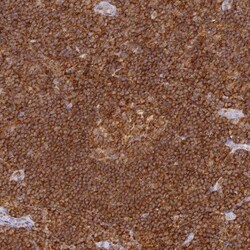 DOCK2 Antibody, Novus Biologicals 0.1mL; Unlabeled:Antibodies, Polyclonal