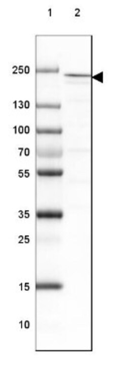 DOCK2 Antibody, Novus Biologicals 0.1mL; Unlabeled:Antibodies, Polyclonal