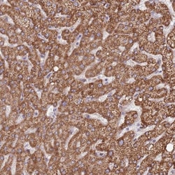DOCK6 Antibody, Novus Biologicals 25 &mu;L, Unlabeled:Antibodies, Polyclonal