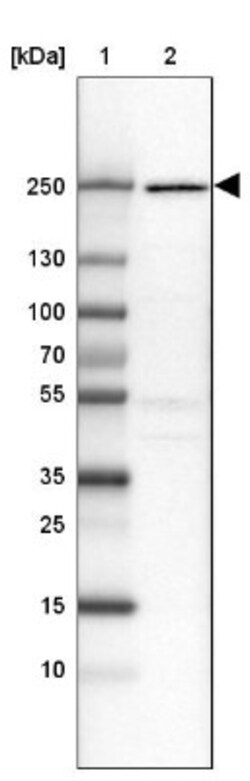 DOCK9 Antibody, Novus Biologicals 25 &mu;L, Unlabeled:Antibodies, Polyclonal
