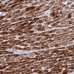 DOK7 Antibody, Novus Biologicals 25 &mu;L, Unlabeled:Antibodies, Polyclonal