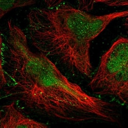 DONSON Antibody, Novus Biologicals 0.1mL; Unlabeled:Antibodies, Polyclonal