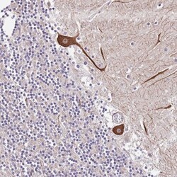 DONSON Antibody, Novus Biologicals 0.1mL; Unlabeled:Antibodies, Polyclonal