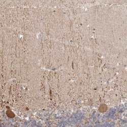 DOPEY1 Antibody, Novus Biologicals 25 &mu;L | Buy Online | Novus Biologicals | Fisher Scientific