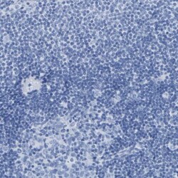 DPEP1 Antibody, Novus Biologicals:Antibodies:Primary Antibodies
