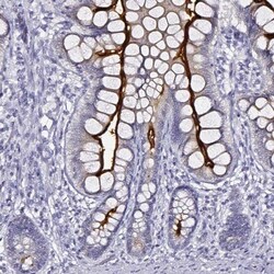 DPEP1 Antibody, Novus Biologicals 25 &mu;L; Unlabeled:Antibodies, Polyclonal