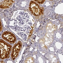 DPEP1 Antibody, Novus Biologicals 25 &mu;L; Unlabeled:Antibodies, Polyclonal