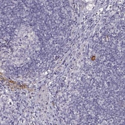 DPEP1 Antibody, Novus Biologicals 25 &mu;L; Unlabeled:Antibodies, Polyclonal
