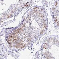 DPEP3 Antibody, Novus Biologicals 25 &mu;L, Unlabeled:Antibodies, Polyclonal