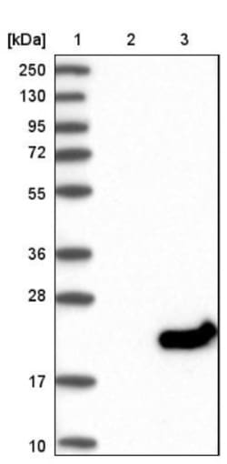 DPH4 Antibody, Novus Biologicals 0.1mL; Unlabeled:Antibodies, Polyclonal