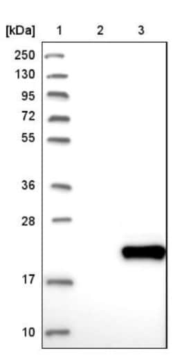 DPH4 Antibody, Novus Biologicals 0.1mL; Unlabeled:Antibodies, Polyclonal