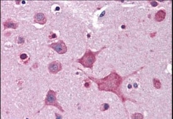 DPP10 Antibody, Novus Biologicals 0.1mg; Unlabeled:Antibodies, Polyclonal