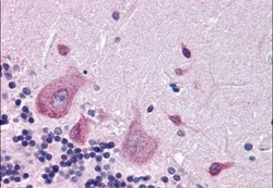 DPP10 Antibody, Novus Biologicals 0.1mg; Unlabeled:Antibodies, Polyclonal