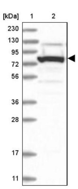 DPP3 Antibody, Novus Biologicals 0.1mL; Unlabeled:Antibodies, Polyclonal