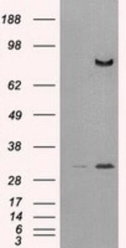 DPPIV/CD26 Antibody (OTI11D7), Novus Biologicals 0.10 ml | Buy Online | Novus Biologicals | Fisher Scientific