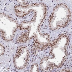 DPY30 Antibody, Novus Biologicals 0.1mL; Unlabeled:Antibodies, Polyclonal