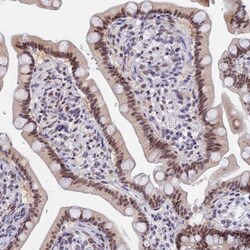 DPY30 Antibody, Novus Biologicals 0.1mL; Unlabeled:Antibodies, Polyclonal