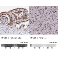 DPY30 Antibody, Novus Biologicals 0.1mL; Unlabeled:Antibodies, Polyclonal