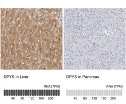DPYS Antibody, Novus Biologicals 0.1mL; Unlabeled:Antibodies, Polyclonal