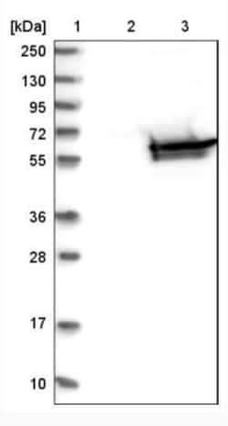 DPYS Antibody, Novus Biologicals 0.1mL; Unlabeled:Antibodies, Polyclonal
